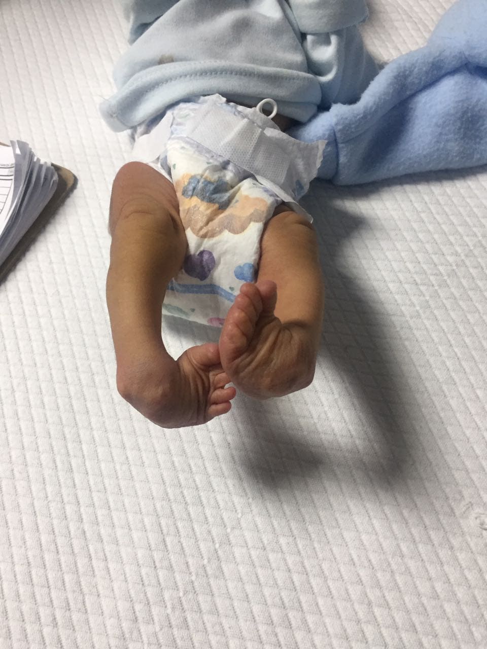 ¿Cómo acceder al tratamiento gratuito del Pie equino varo en Guayaquil