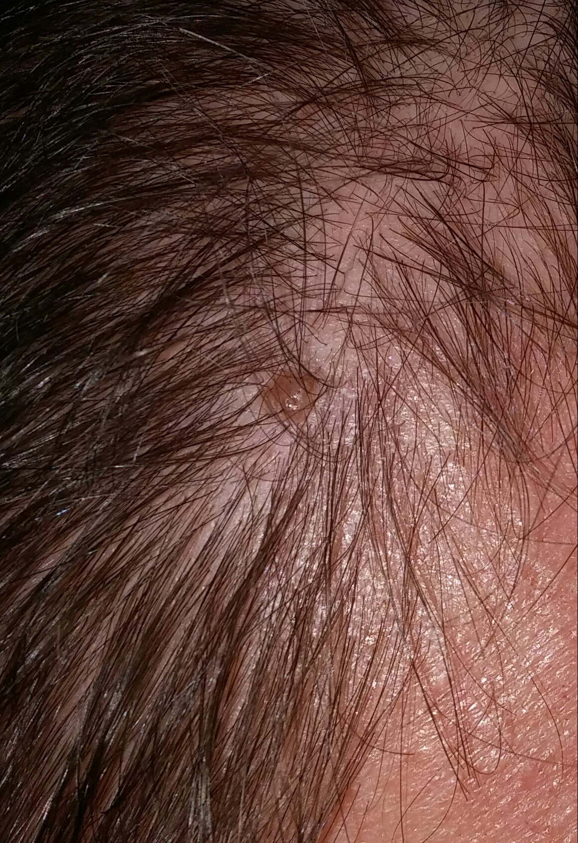 I have growth on my scalp, getting bigger? Ask a doctor free. Share