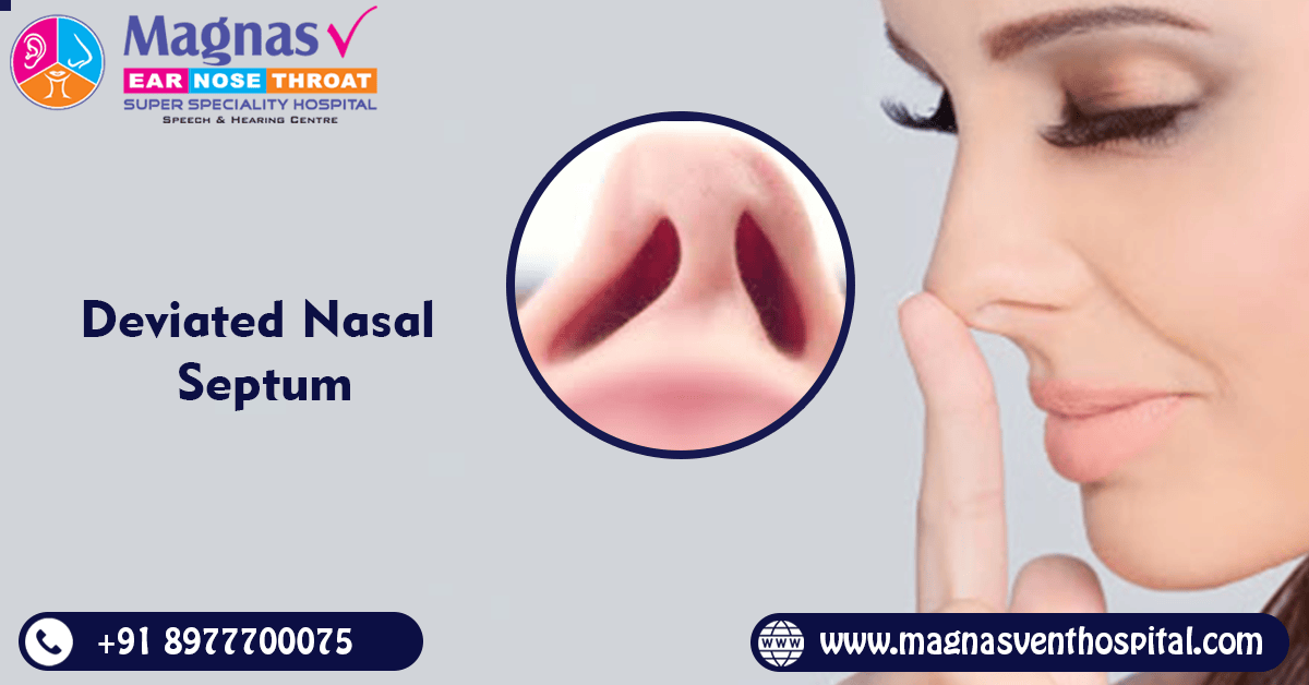 Deviated Nasal Septum Treatment in Hyderabad QuickMarket Free