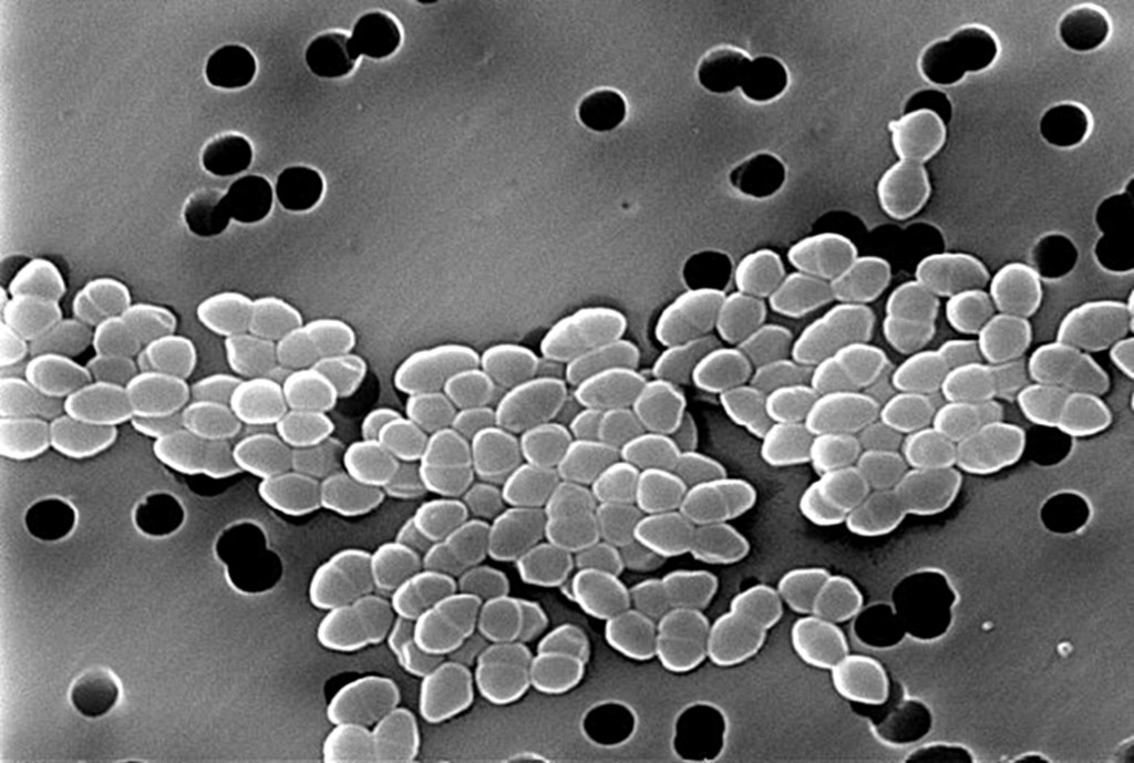 resistant Enterococcus faecalis Quip Labs