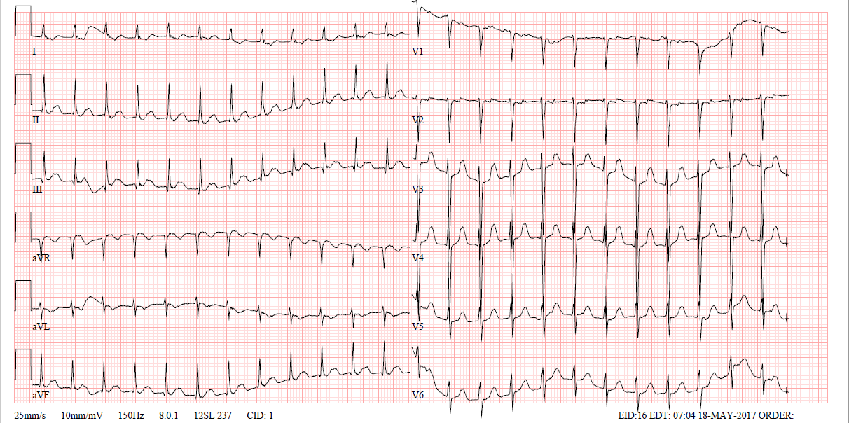 ECG final Quiz | Quizizz
