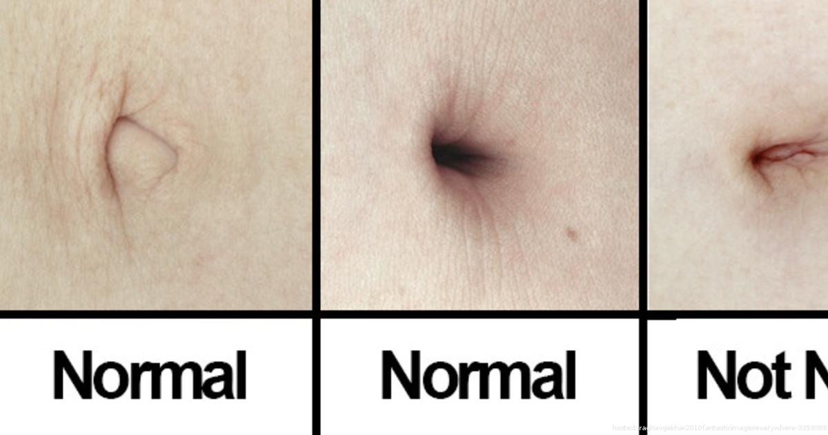 Types Of Belly Buttons