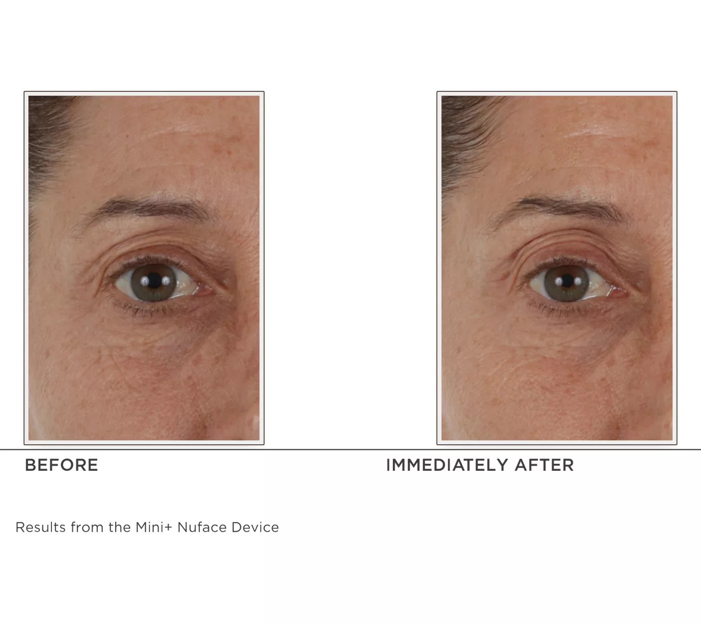 NuFACE Mini+ Facial Toning Device with 3.3oz Aqua Gel and Brush