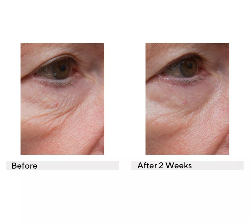 philosophy ultimate miracleworker moisturizer SPF 30 2oz duo