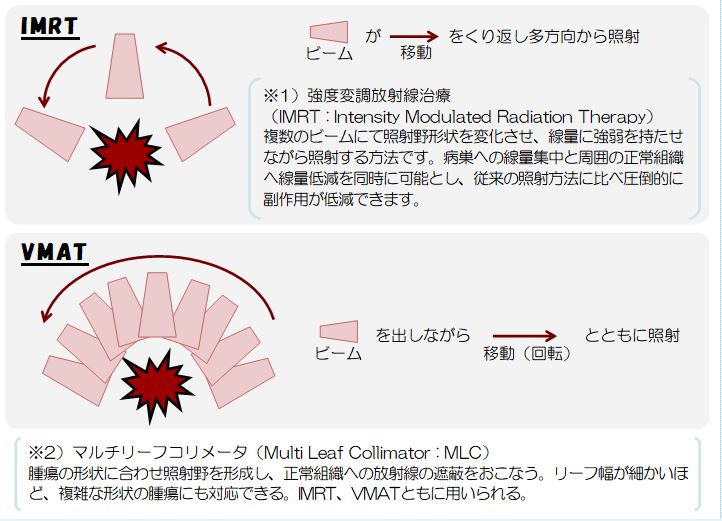 VMATご存知ですか？ RadiologyHome