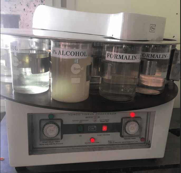 Automatic Tissue Processor Radhika Instruments