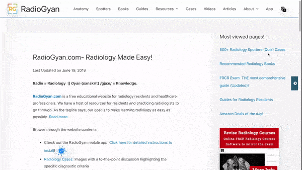 TIRADS Calculator USG Thyroid Nodule Score in