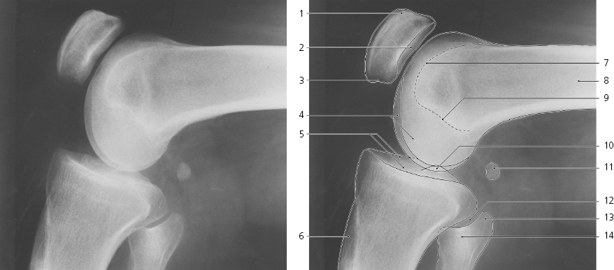 Knee Radiology Key