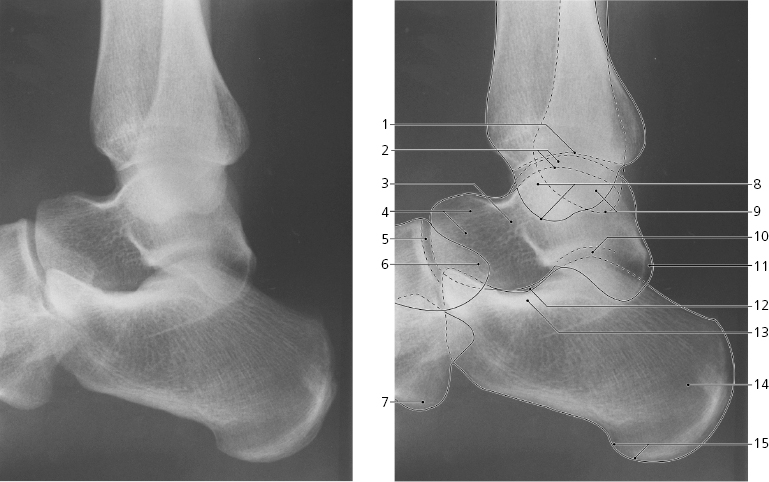 and Foot Radiology Key