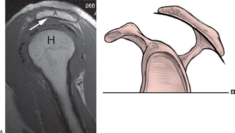 The Shoulder Radiology Key