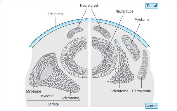 Malformations of the Spinal Canal Radiology Key