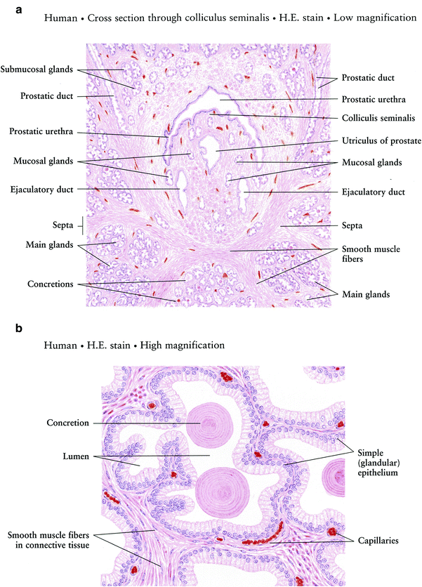 Seminal Vesicle, Penis, and Urethra Radiology Key