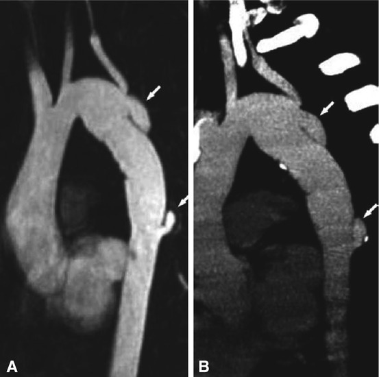 Congenital and Acquired Heart Disease Radiology Key