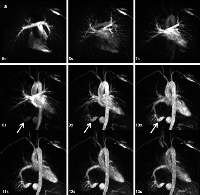 Resonance Angiography Radiology Key