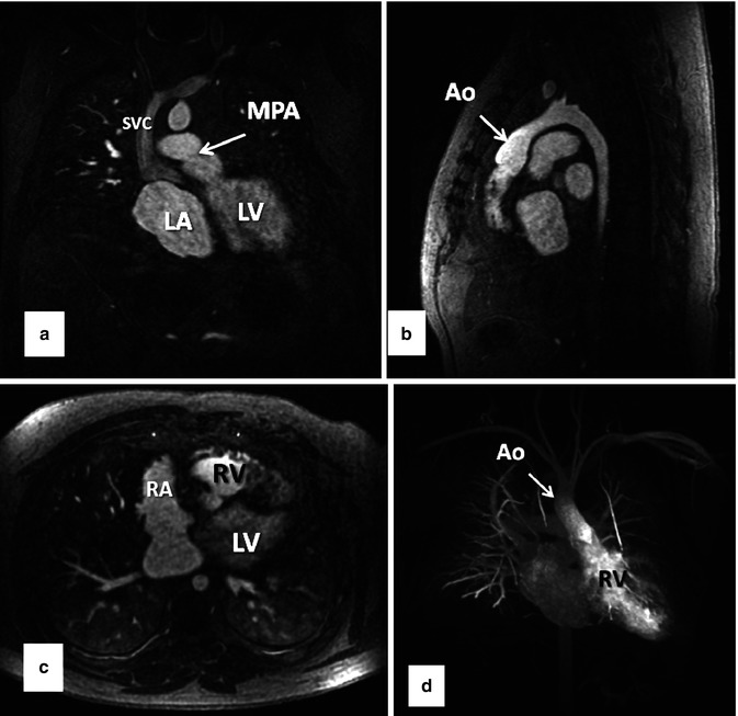 Resonance Angiography Radiology Key