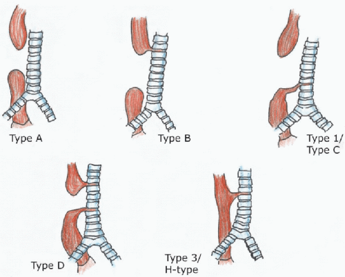 Lower Airway Obstruction Radiology Key
