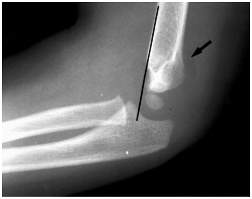 The Elbow Radiology Key