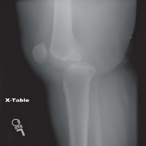 Knee Dislocation Radiology Key