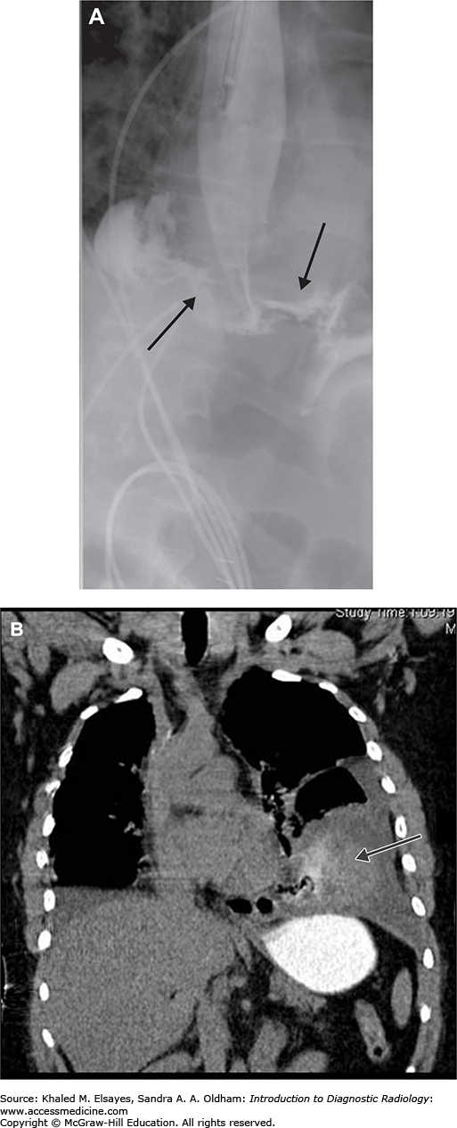 Gastrointestinal Imaging Radiology Key