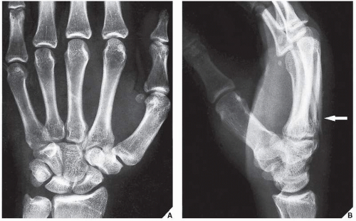 Radiologic Evaluation of Trauma Radiology Key