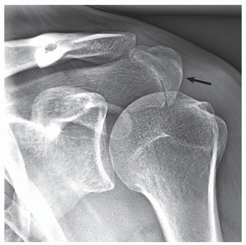 Upper Limb I Shoulder Girdle Radiology Key