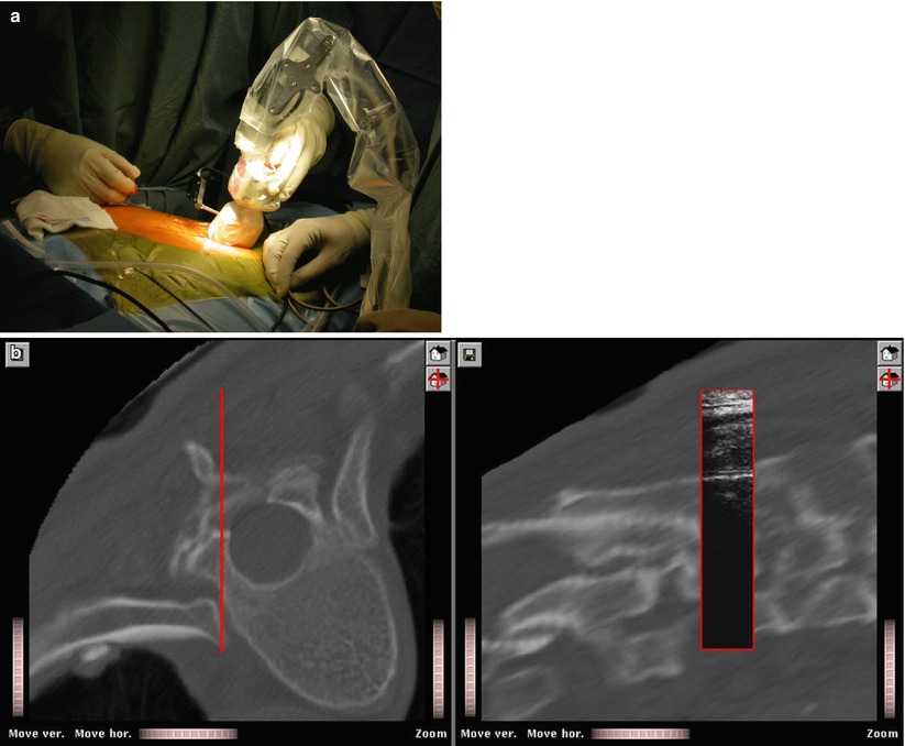 ImageGuided Orthopaedic Surgery Radiology Key
