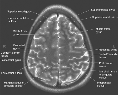 Introduction to Brain Imaging Radiology Key