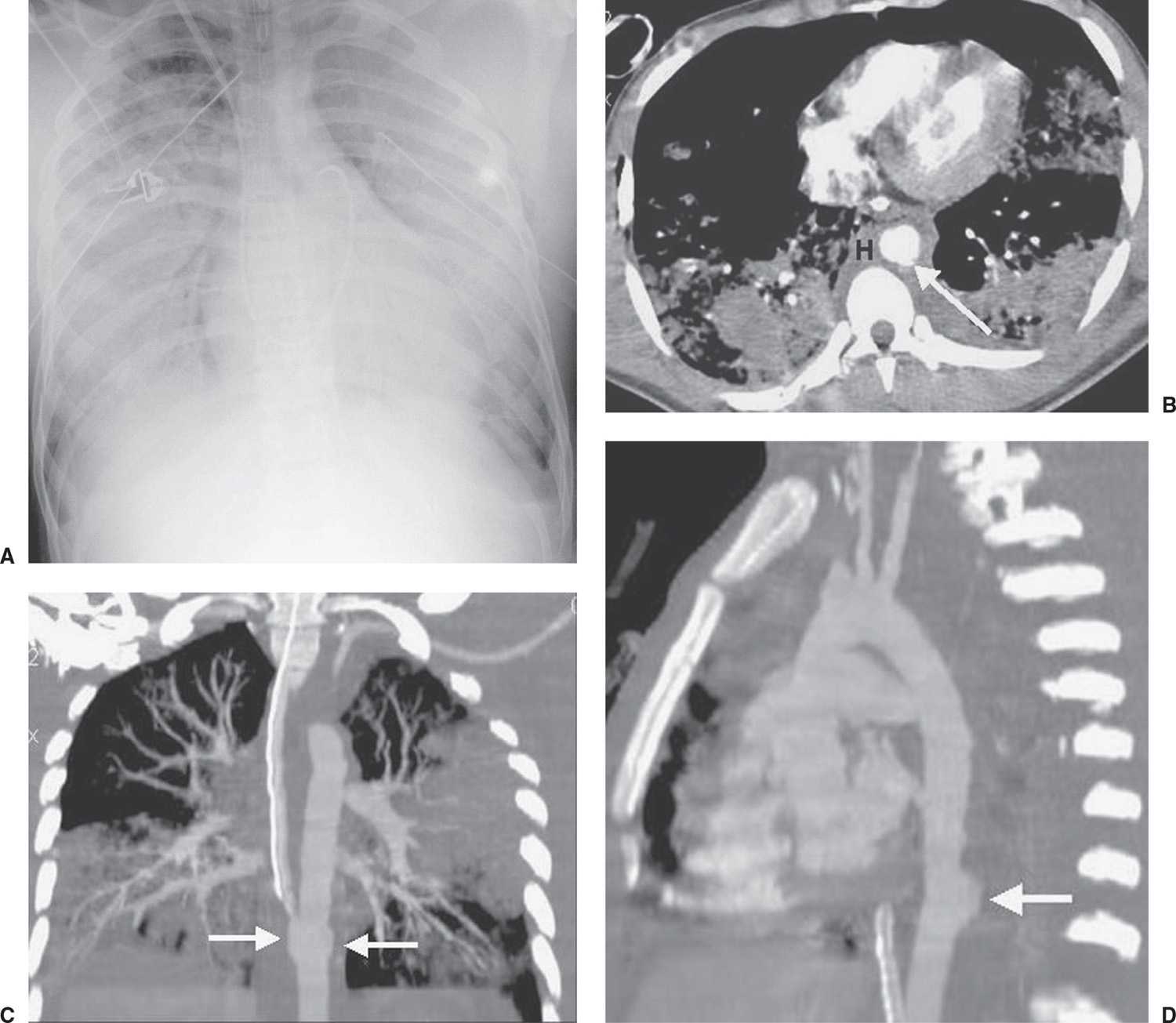 Chest Trauma Radiology Key