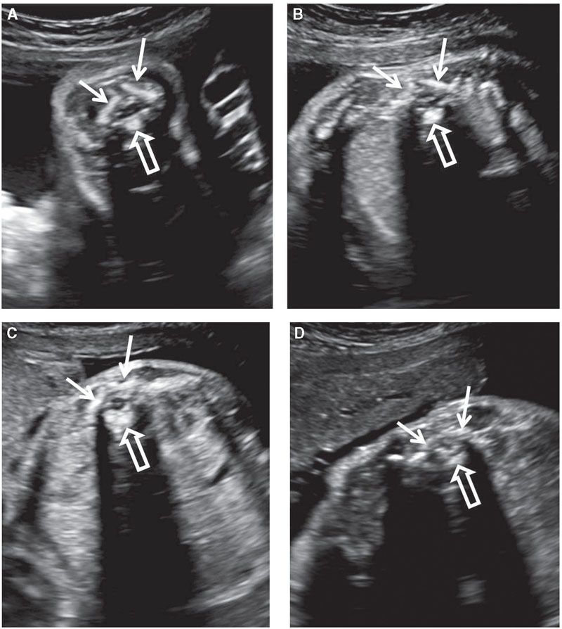 Normal Fetal Ultrasound Survey Radiology Key