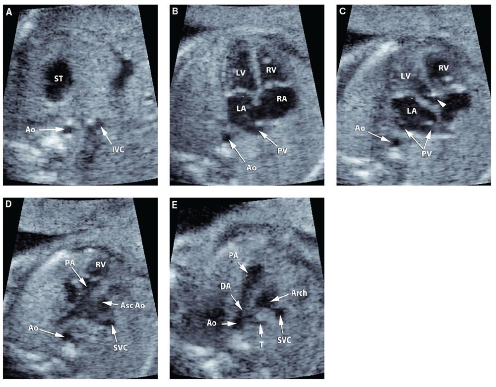ThreeDimensional Ultrasonography Radiology Key