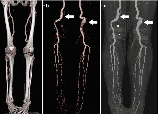 Upper And Lower Limb Imaging | Radiology Key