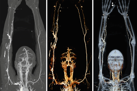Upper And Lower Limb Imaging | Radiology Key