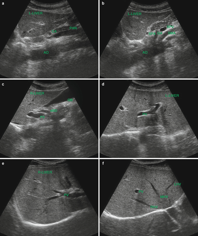 Liver Ultrasound Hepatitis