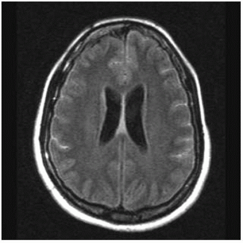 Infections and Inflammations Radiology Key