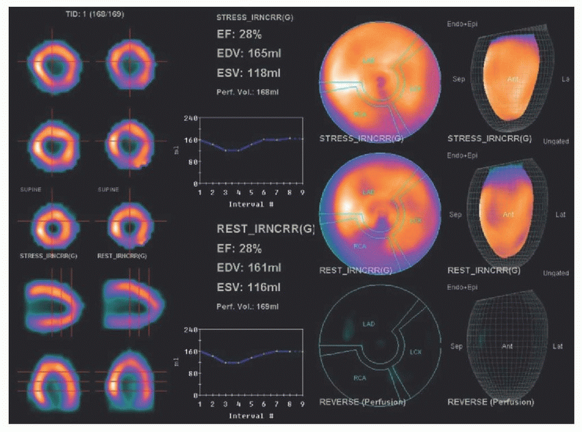 Nuclear Cardiology Radiology Key