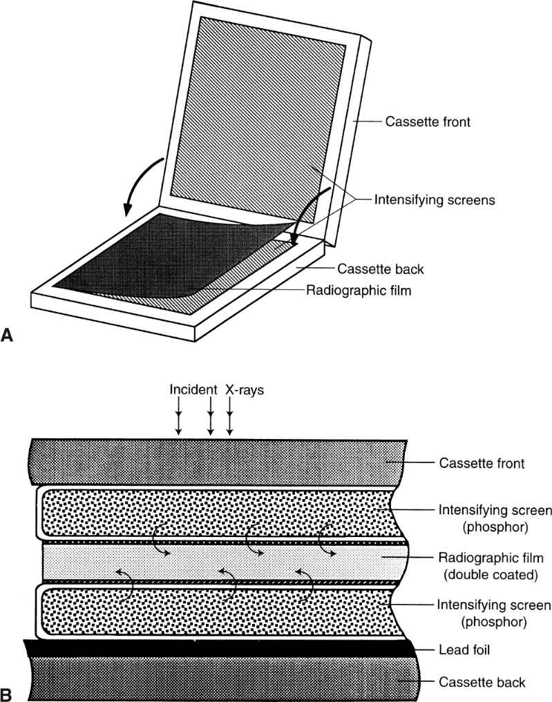 Radiology Film Screen Cassette