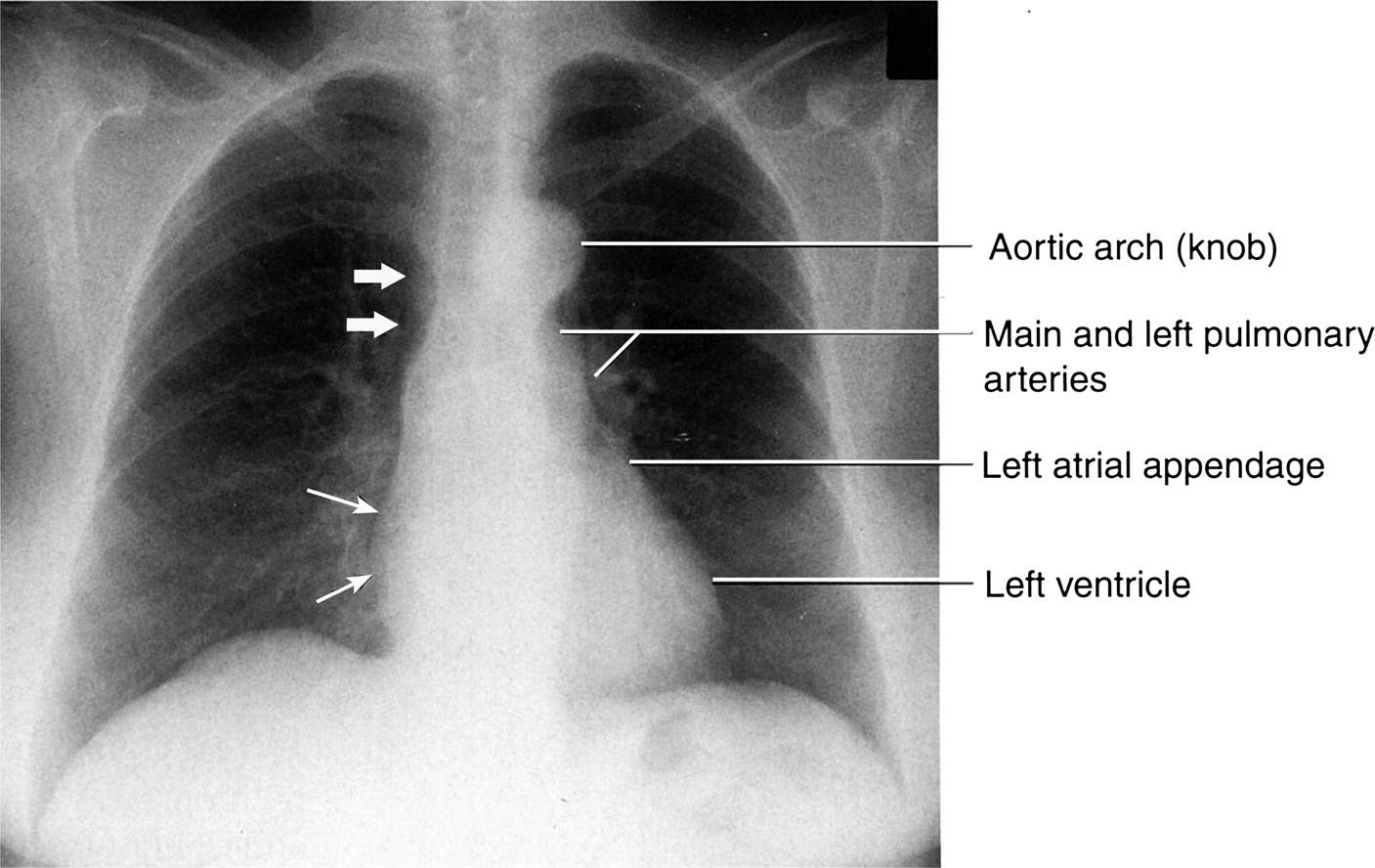 Chest Radiology Key