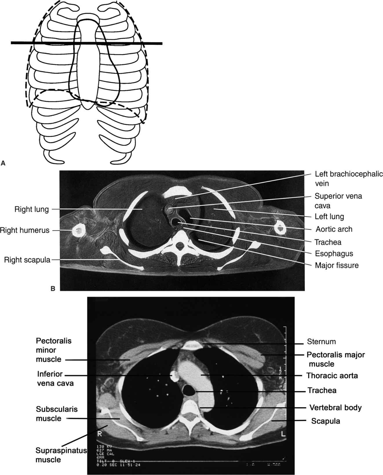 Chest Radiology Key