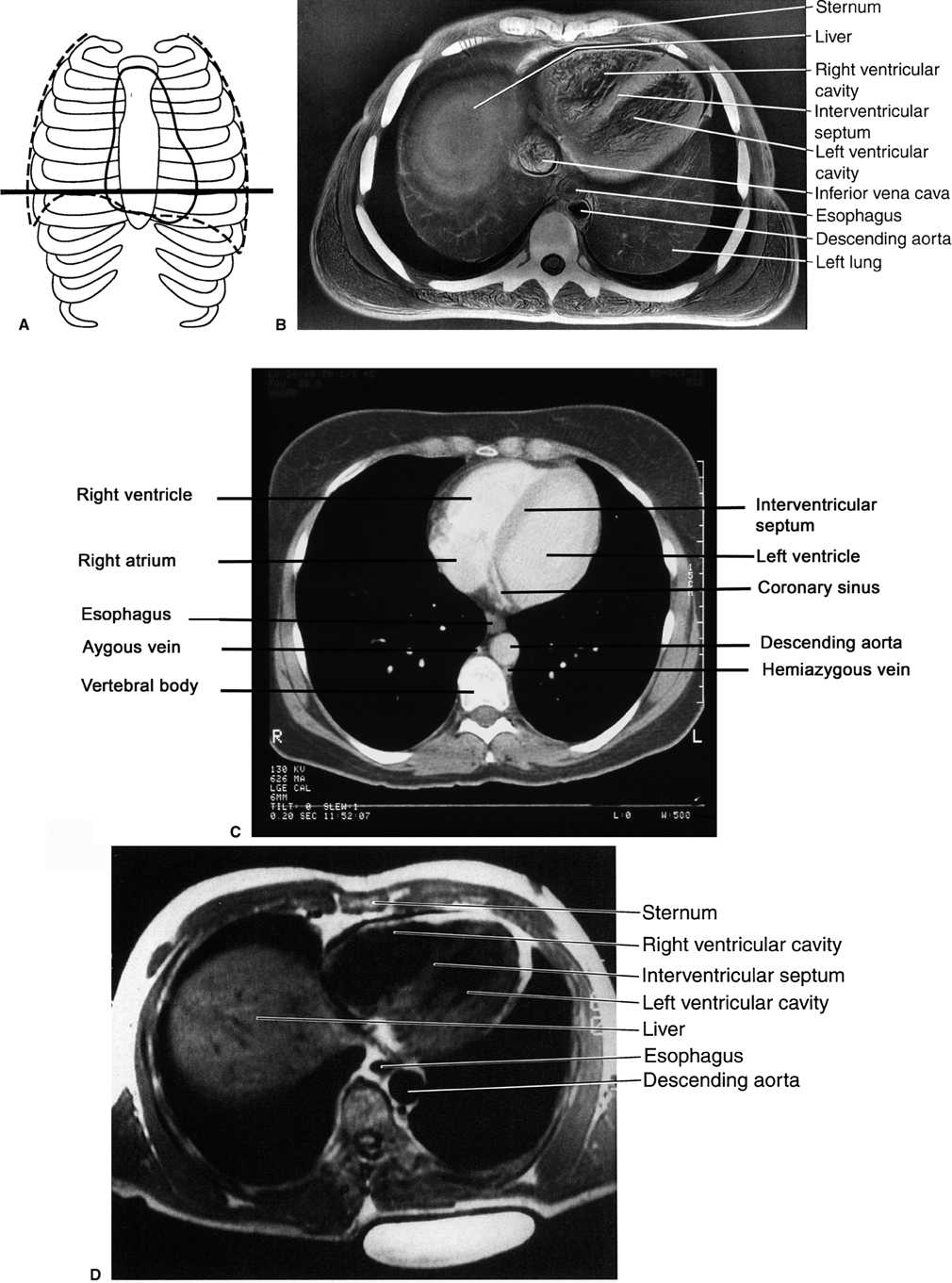 Chest Radiology Key