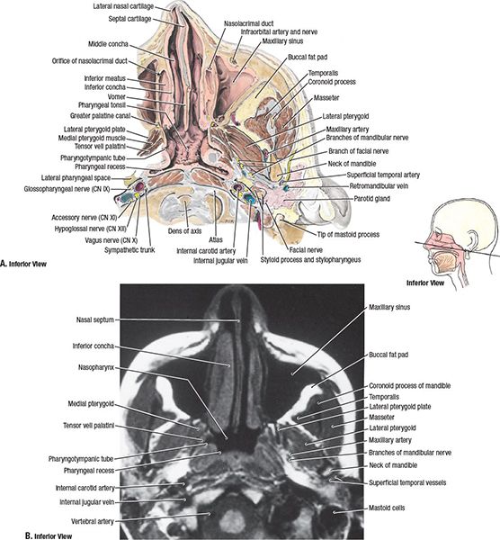 Nasopharynx Radiology Key
