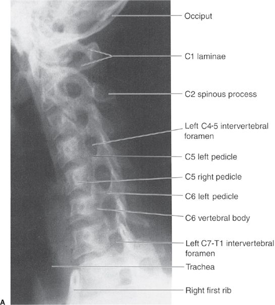Spine and Pelvis Radiology Key