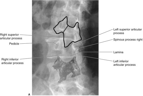 Spine and Pelvis Radiology Key