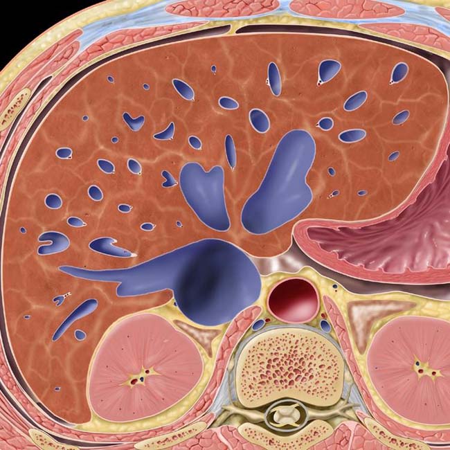 Passive Hepatic Congestion Radiology Key