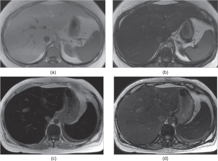 The crosssectional imaging techniques and diagnostic approach