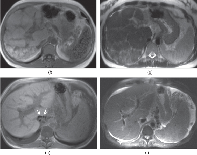 The crosssectional imaging techniques and diagnostic approach