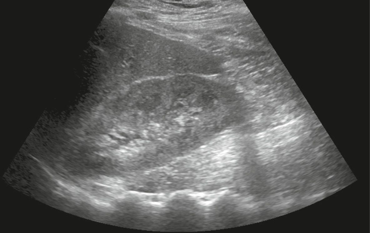 and right kidney Radiology Key