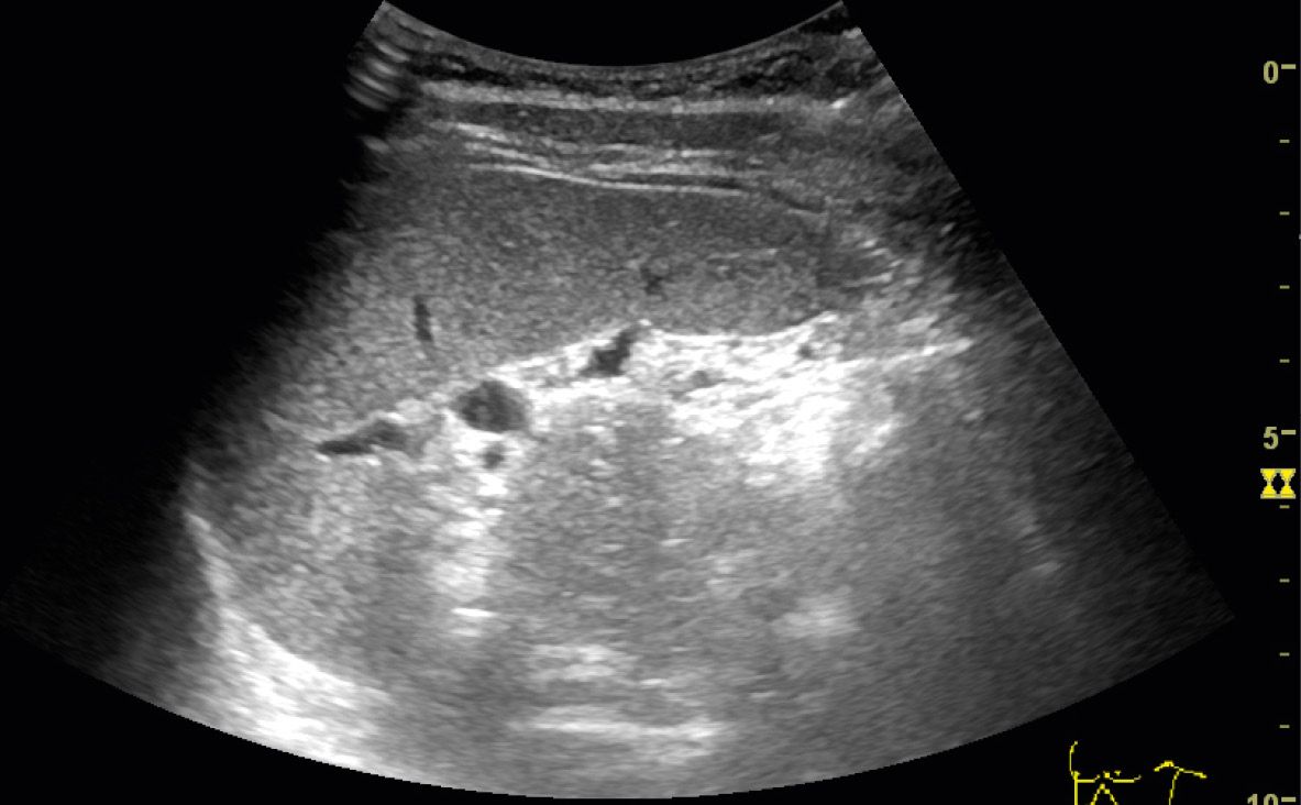 and left kidney Radiology Key