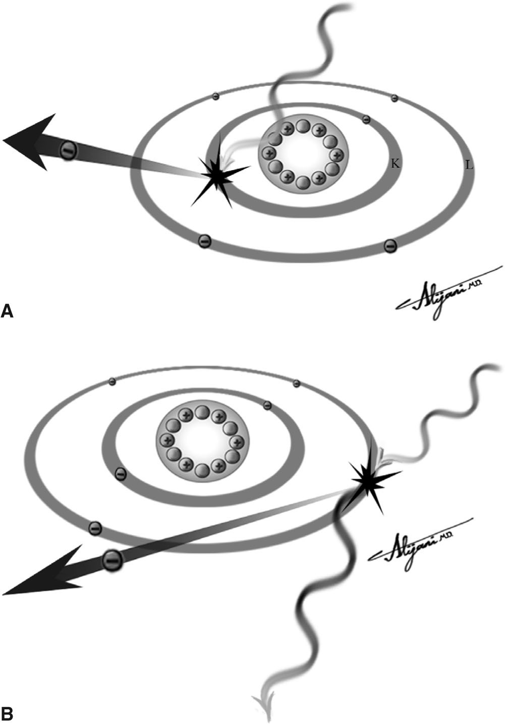 Photoelectric Effect X Ray