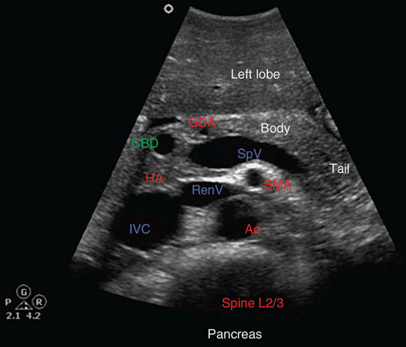 Ultrasound of the Pancreas Radiology Key