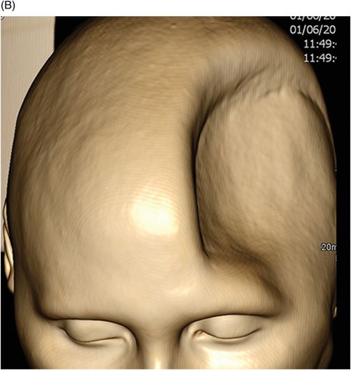 127 Radiology Key